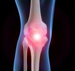 Osteoartrit (Kireçlenme) Nedir